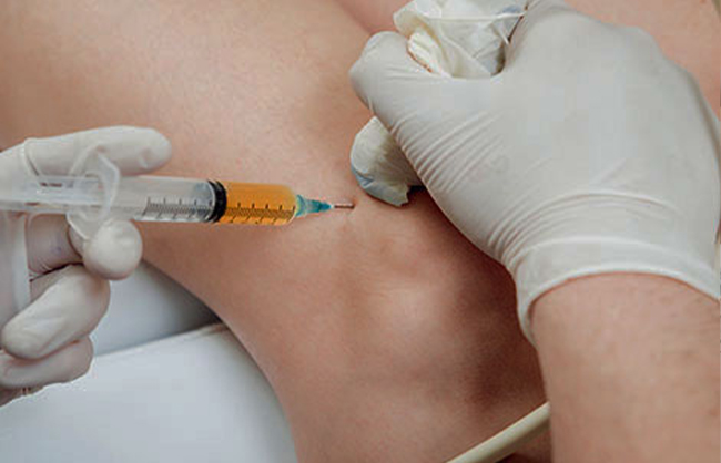 Platelet-Rich Plasma in Capitola, California